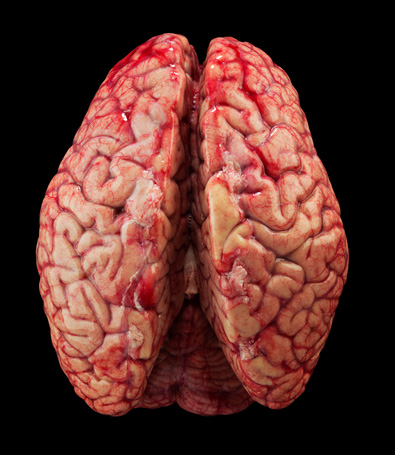 Picture of the human brain, top view